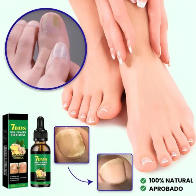 SereaRepair - Aceite Antihongos Uñas