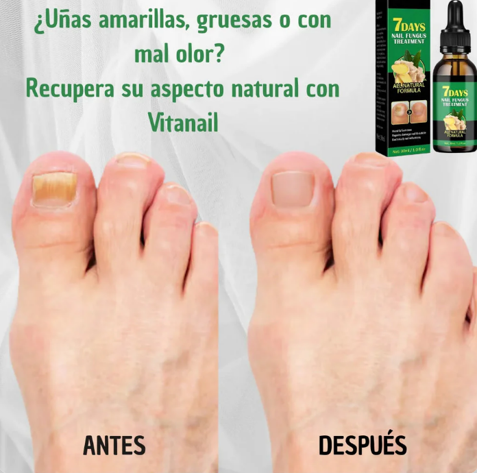 SereaRepair - Aceite Antihongos Uñas