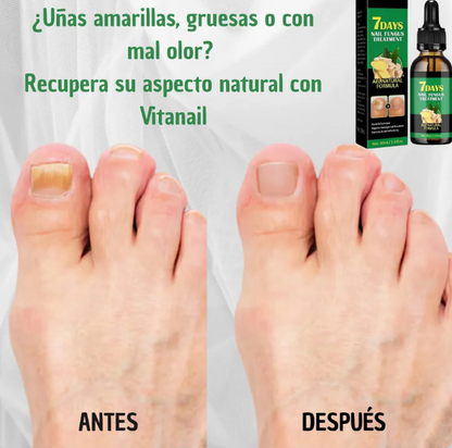 SereaRepair - Aceite Antihongos Uñas