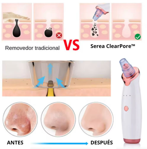 Serea ClearPore™